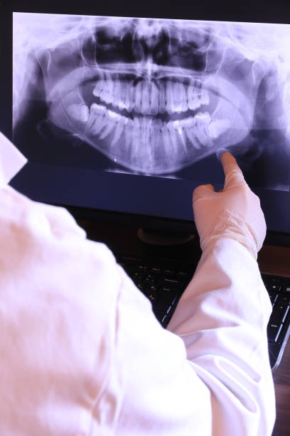 Best Emergency Wisdom Teeth Removal in Watseka, IL