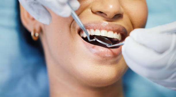 Best Emergency Dental Care for Broken or Chipped Teeth in Watseka, IL